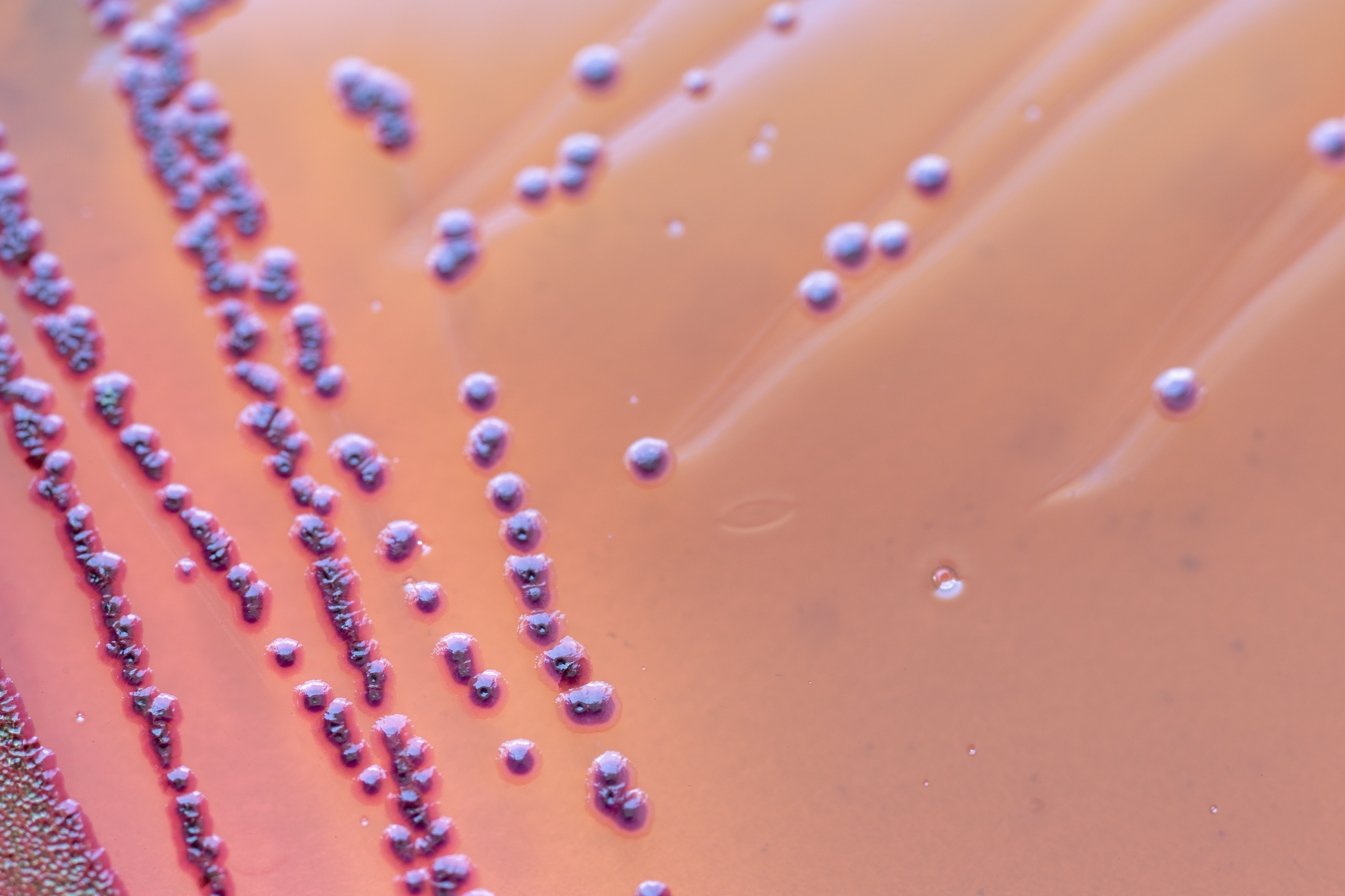 Listeria