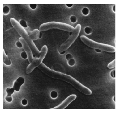 Arcobacter_butzleri_Figure2