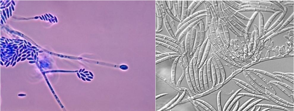 Fusarium verticillioides et Fusarium graminearum 