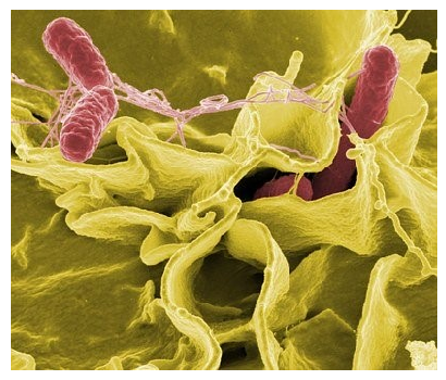 salmonella