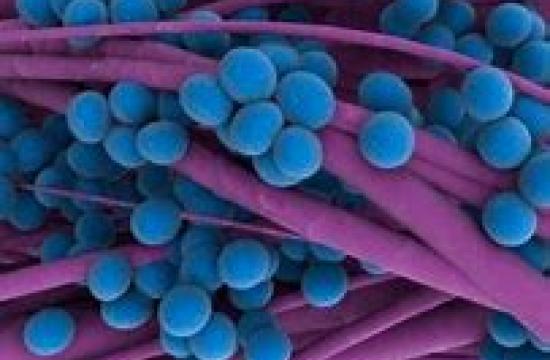 ​Figure 2. S. aureus