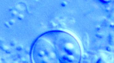 Cyclospora cayetanensis