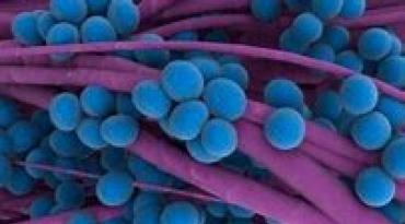 ​Figure 2. S. aureus