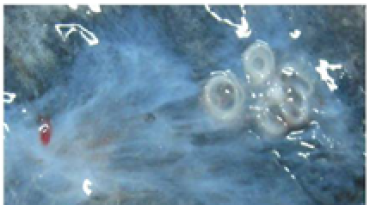 Anisakis flanc lotte