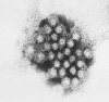 Norovirus